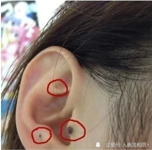 耳朵有痣都为吉痣,除了耳根的痣身体不佳,其他的都不错,耳垂有痣的人