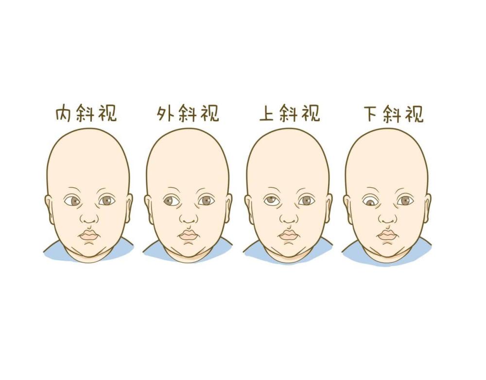 这种眼病,作为家长的你必须得了解!