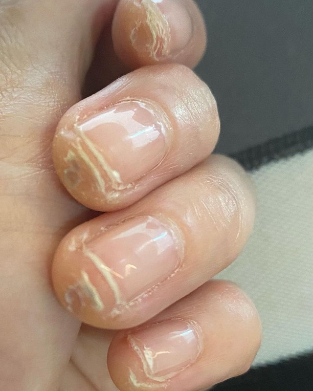 徐若瑄苦练吉他分享成果 留手指厚茧作纪念