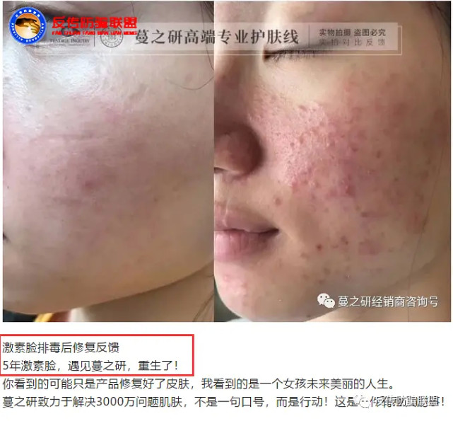 “蔓之研”两次虚假宣传被罚：多级代理模式涉嫌传销(图5)