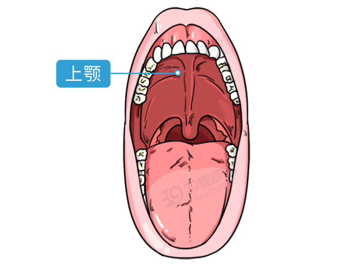 腭神经节神经痛也叫"冰淇淋头痛"此时可对太阳穴进行按摩促进局部血液