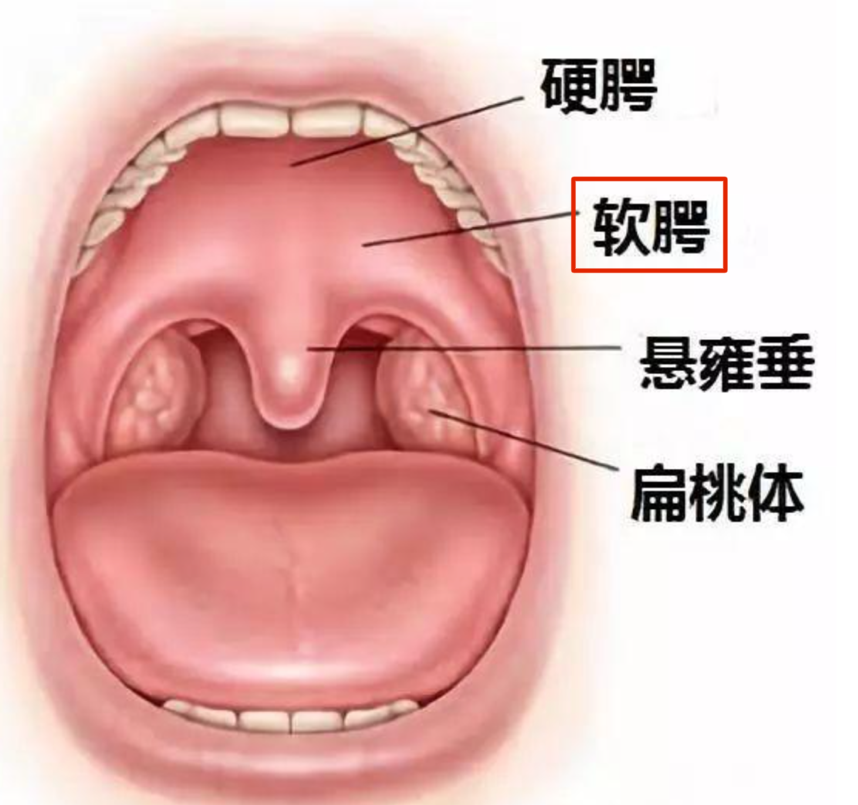 腭舌弓和腭咽弓位置图图片