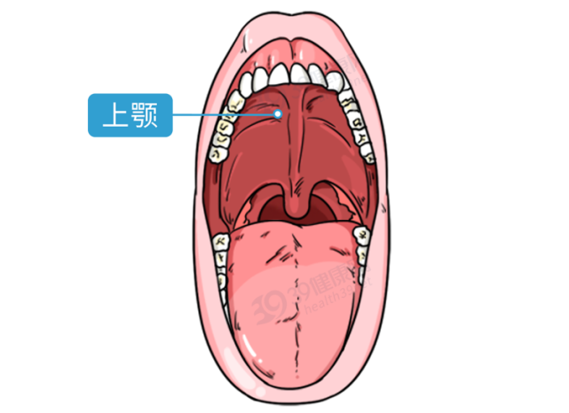 口腔上颚结构图片