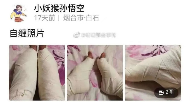 让人难以想象的是,"缠足"竟然在2021年卷土重来了.