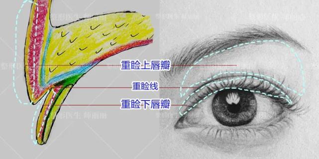 眼修复中 三层 修复 修复不止要改善形态还要恢复眼睛正常功能 师丽丽主治医师 爱问医生