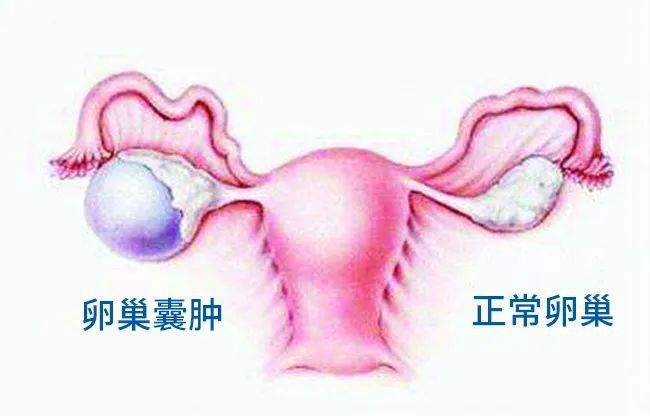 憩室可以做试管吗(子宫憩室可以做试管吗)-第1张图片-鲸幼网