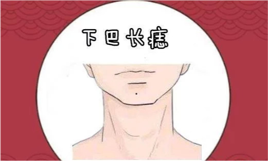 身上5颗房产痣,命里藏财,男添宅,女添田,一代必定富过一代!