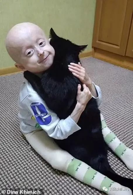 才华横溢的早衰女孩,10岁的年龄,被困在80岁的身体里