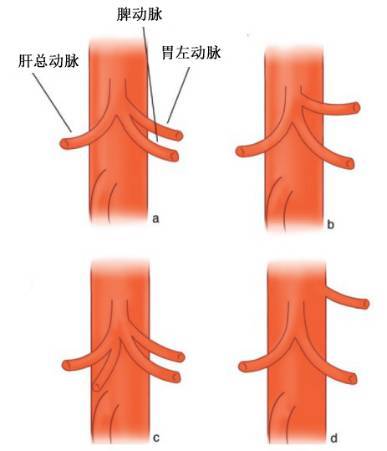 腹腔乾的解剖,講的太詳細了|腹腔|動脈|胃十二指腸動脈