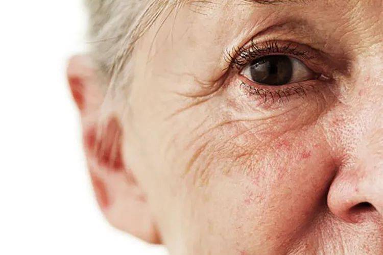 糖真的是导致皮肤衰老的罪魁祸首?