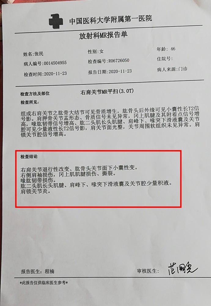 沈阳48岁母亲不幸身患癌症,家人还等我回家,恳请大家救救我!