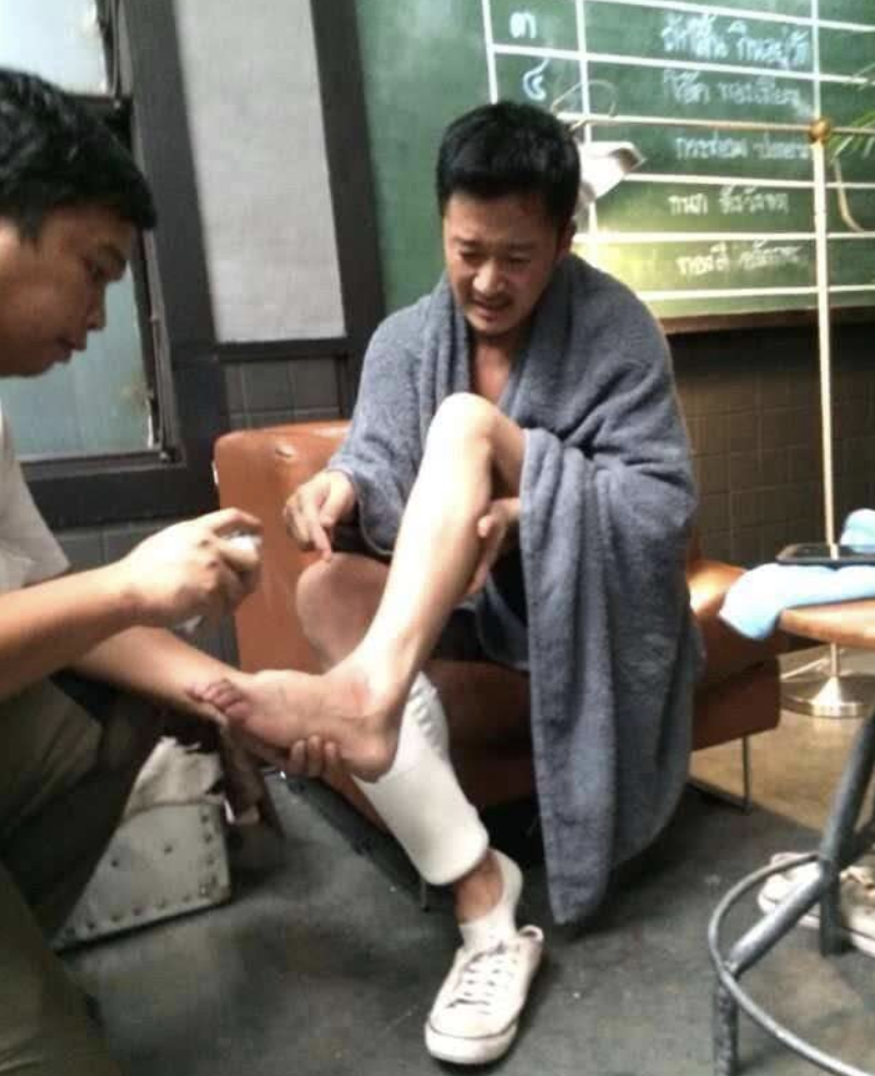 粉丝整理吴京受伤图,断骨拉伤是家常便饭,全身缝过100多针超敬业