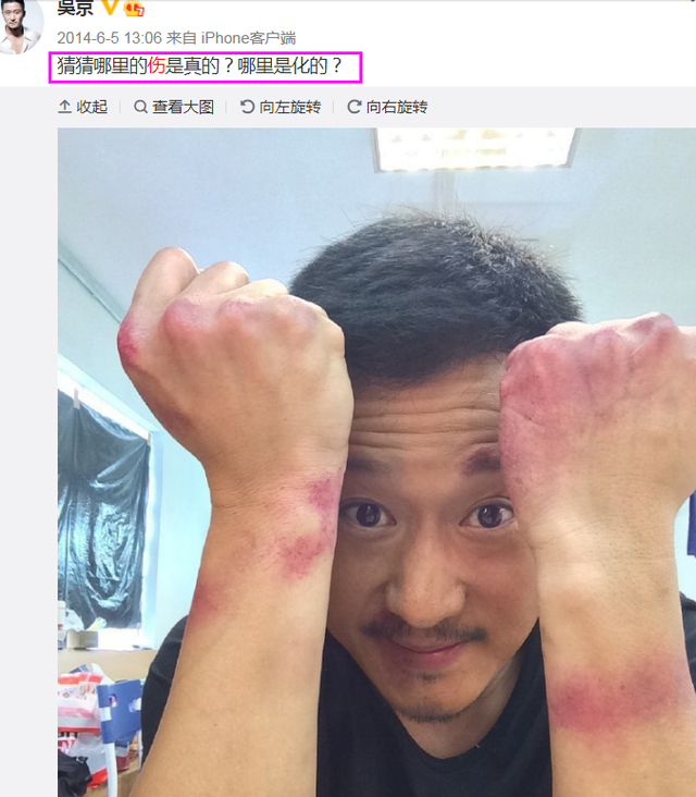 粉丝做的吴京伤处汇总图,全身缝过100多针,盘点他曾经受伤的画面令人