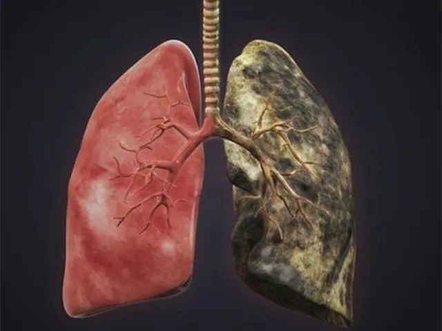 你的肺真的安全吗 身体的这几种 信号 一定要注意 腾讯新闻