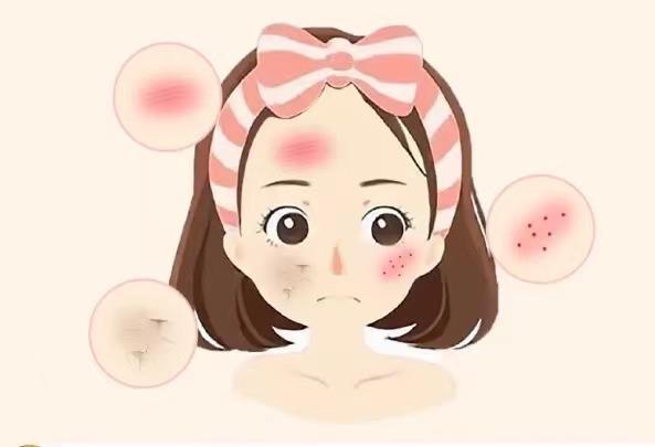 护肤小知识你要知道的敏感肌护理