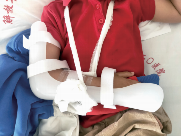 联勤保障部队第九二〇医院住院部骨科四病区,看到恩德右前臂缠着绷带