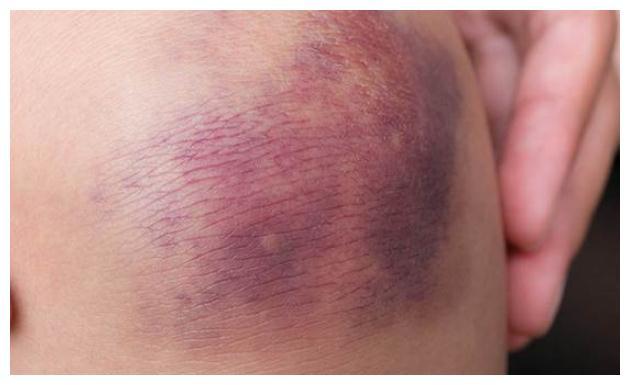 1992年山西一工人捡到"小铁块",全家三人丧命,致141人受伤