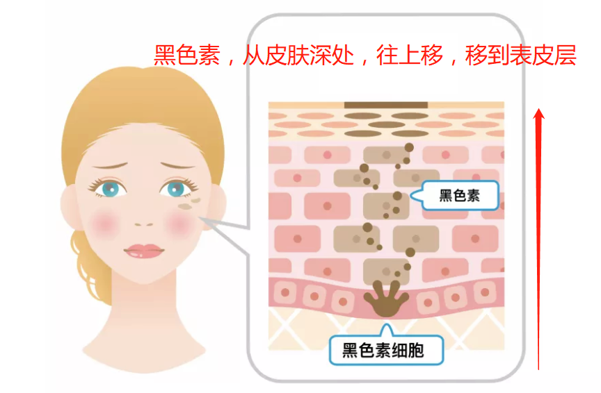 我们要明白, 我们的皮肤是怎么样变黑的 做好防晒,从源头阻止了黑色素