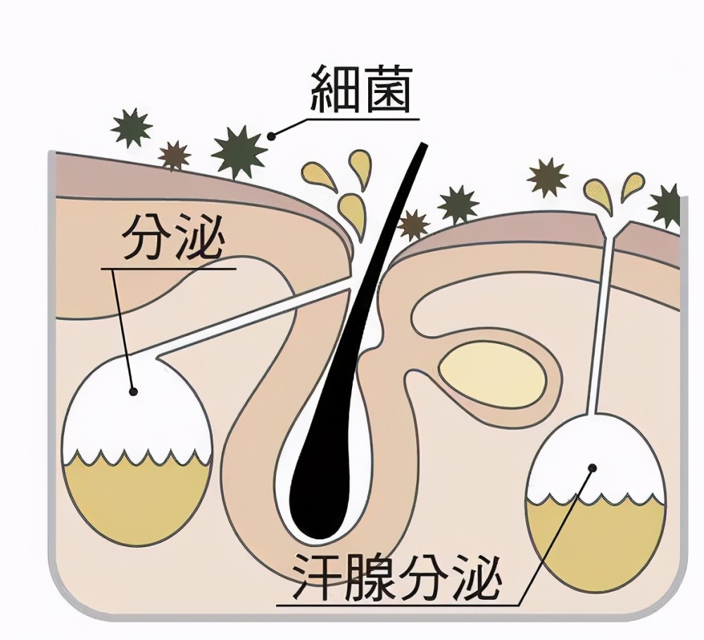 bromhidrosis)的俗称,又称腋臭,是由腋窝处顶泌汗腺的分泌物经皮肤上