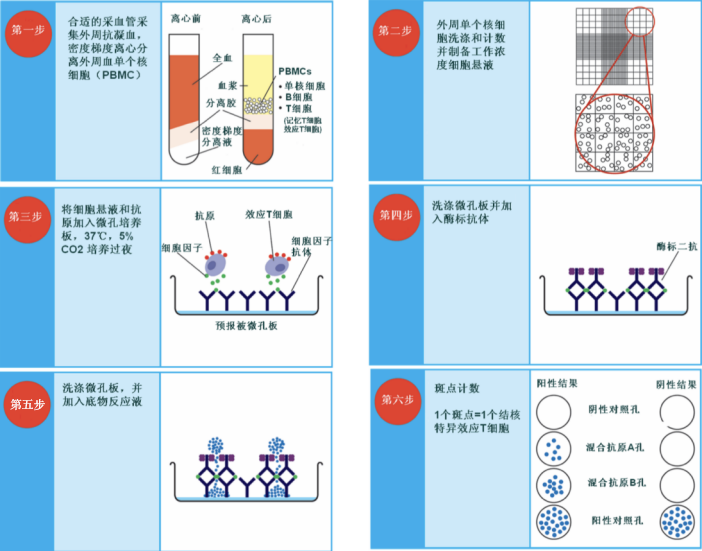 T Spot检查在诊断结核中到底有多大意义 腾讯新闻