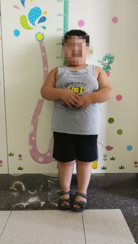 5岁儿子体重76斤,查出脂肪肝倾向!最近杭城医院这个门诊爆满|祁正红|