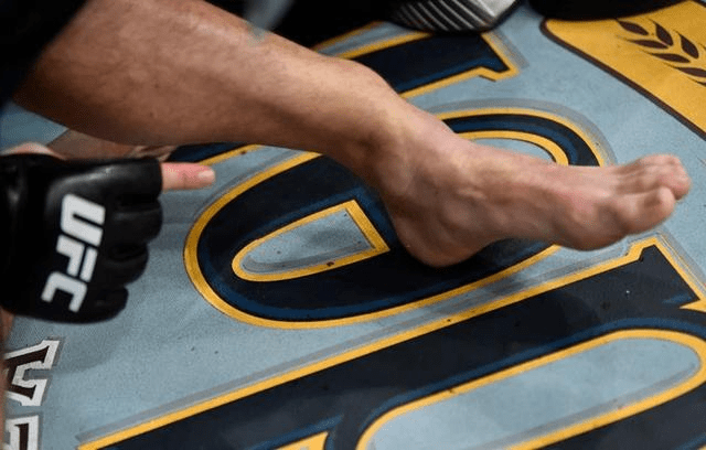 嘴炮康纳拿生命在赚钱:断腿遭tko,或就此退役_腾讯新闻