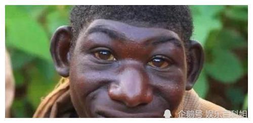 非洲"猴娃"艾力:长相返祖以吃水果为食,7天能跑460里