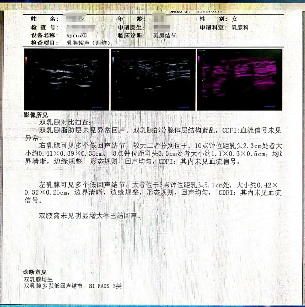 超声科普教你读懂乳腺超声检查报告