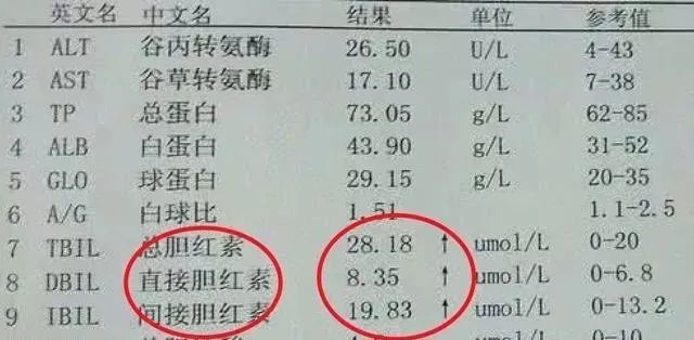 從化驗單,怎麼看乙肝病輕重?