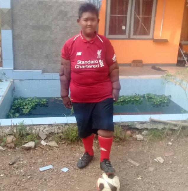 曾经世界最胖小孩,健身减重240斤,蜕变阳光帅气少年重获新生