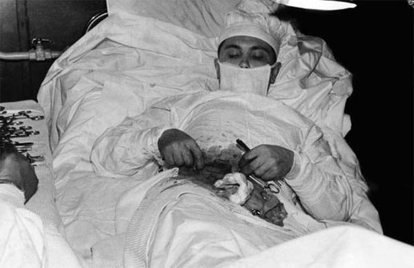 1961年在南极,列昂尼德突然肚子剧痛,于是他切开了自己的肚子