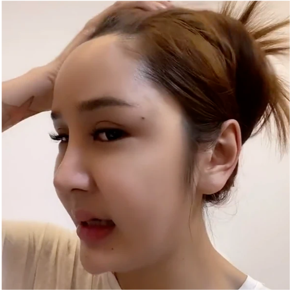 不过就算整容风险大,也不能阻挡某些人追求"美丽"的那颗心.