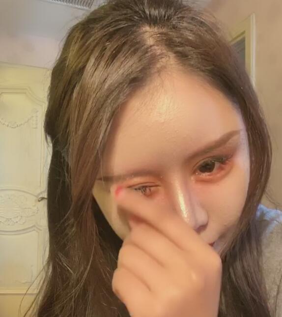 网红小z娜娜向网友展示整容400次的最新成果整张脸非常夸张