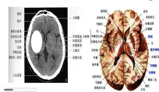 紋狀體讓位於皮質運動區而受制於後者,維持肌張力和調節身體姿勢,負責