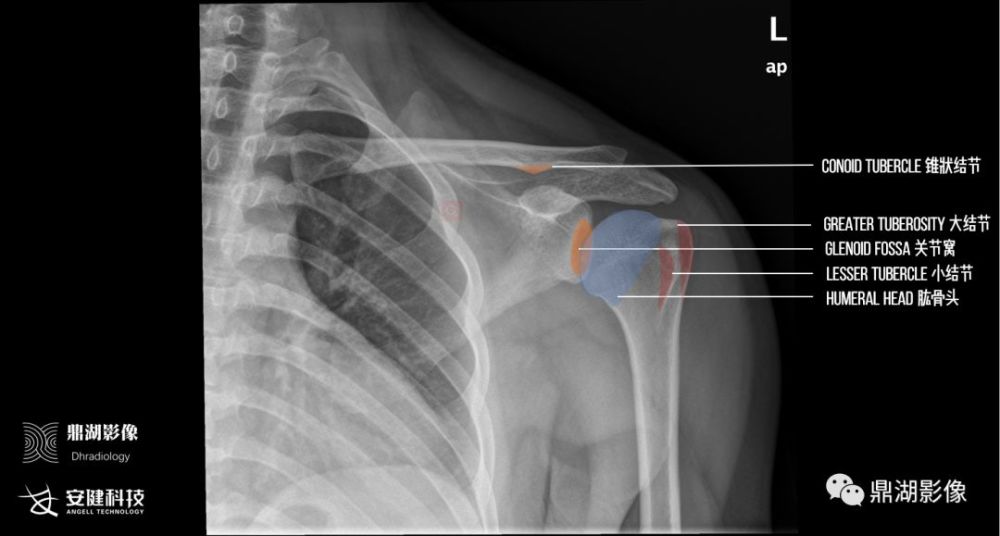 x线高清图谱|精致肩关节解剖
