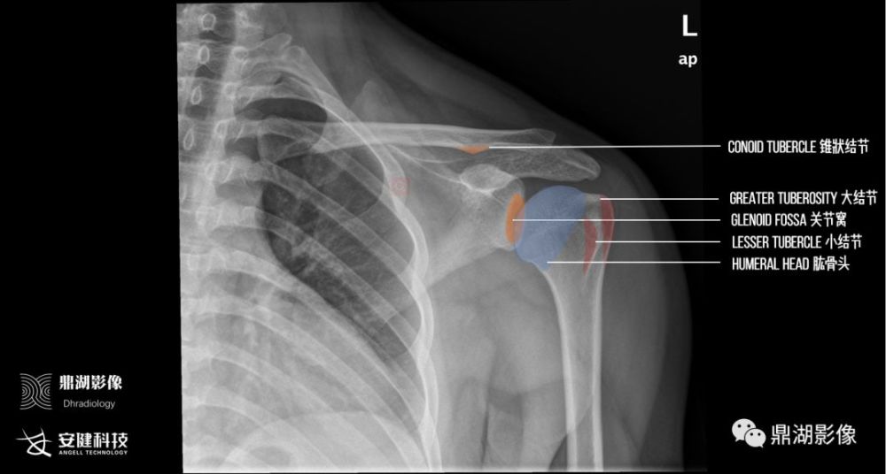 x线高清图谱精致肩关节解剖