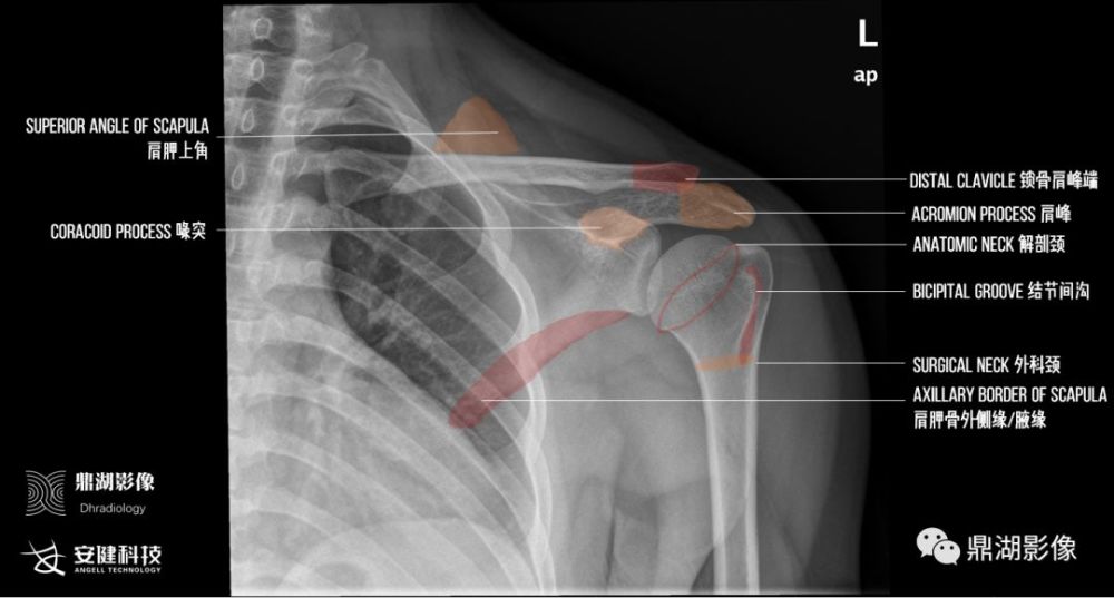 x线高清图谱|精致肩关节解剖