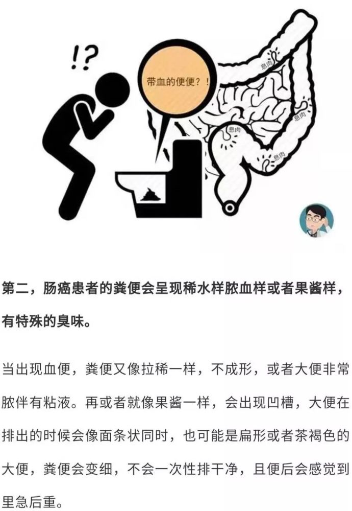 肠癌患者血便的颜色会发黑发红,在大便的隐血试验中多为阳性.