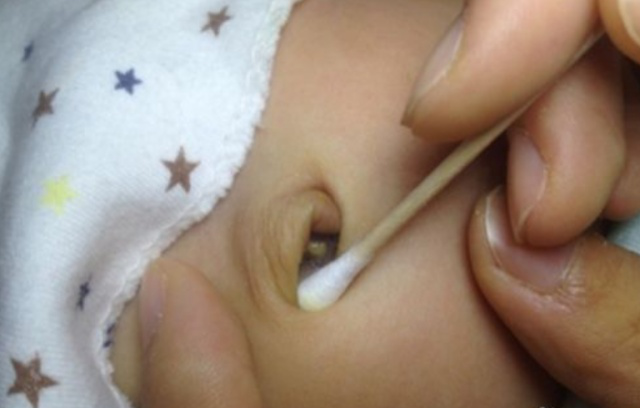 肚脐里的泥是什么,能不能用手抠呢?可能很多人都搞错了