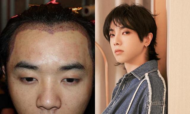 前女友晒照称华晨宇整容斥张碧晨介入感情歌迷会称只关注作品