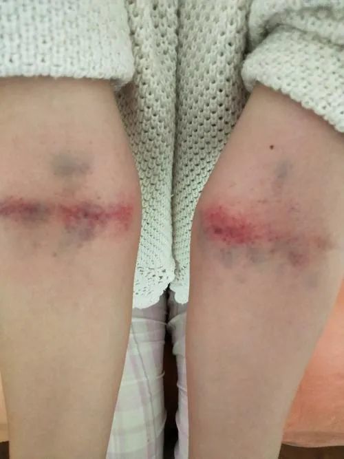 这四个地方通了心肝脾肺肾就都好了