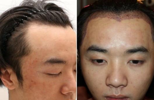 7月16日,微博用户"发发爱我201"晒出九宫格照片,称华晨宇在医院整容的