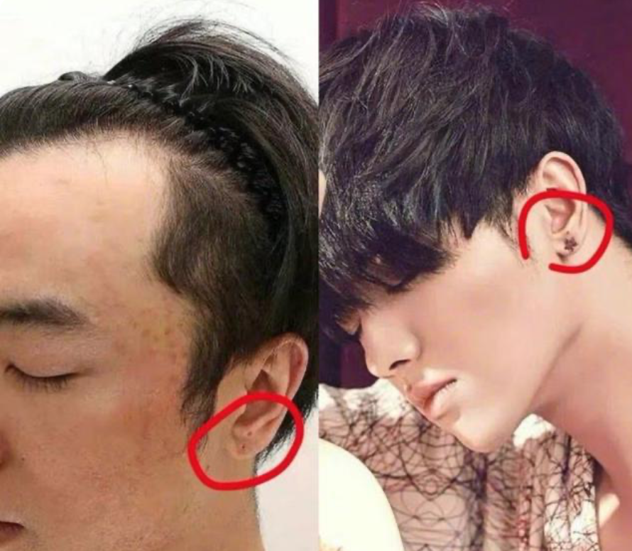 华晨宇植发分层(华晨宇 植发 知乎)
