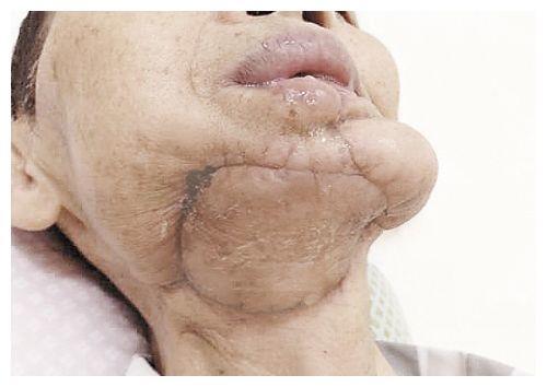 "软性毒品"槟榔,6千万国人的炸弹,有人在辩解,有人浑然不觉