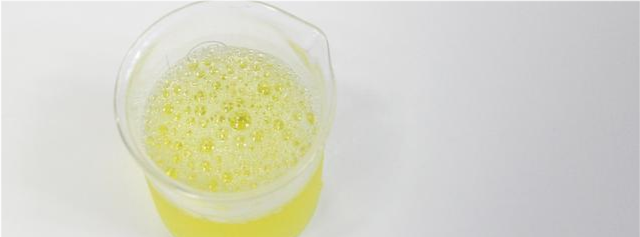 第一种竟是结晶尿?