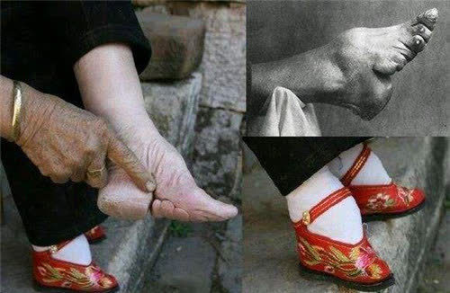 民国小脚夫人:靠一双小脚嫁人,却遭丈夫嫌弃,洗脚总会疼出冷汗