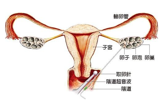 黃荷鳳告訴記者,卵母細胞的水分含量較高,冷凍過程中易受損傷.