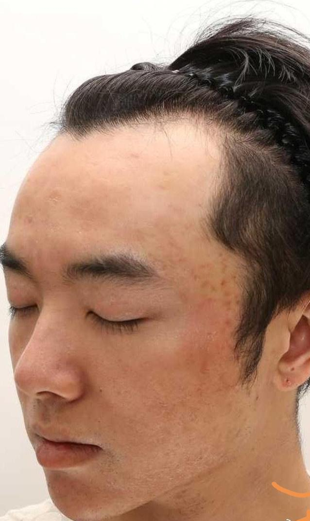 华晨宇承认图片是本人但否认整容植发画面雷人张碧晨辟谣插足他人感情