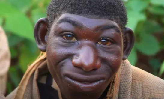 23岁非洲男子长相如猴子还爱吃香蕉常被人当动物欺负