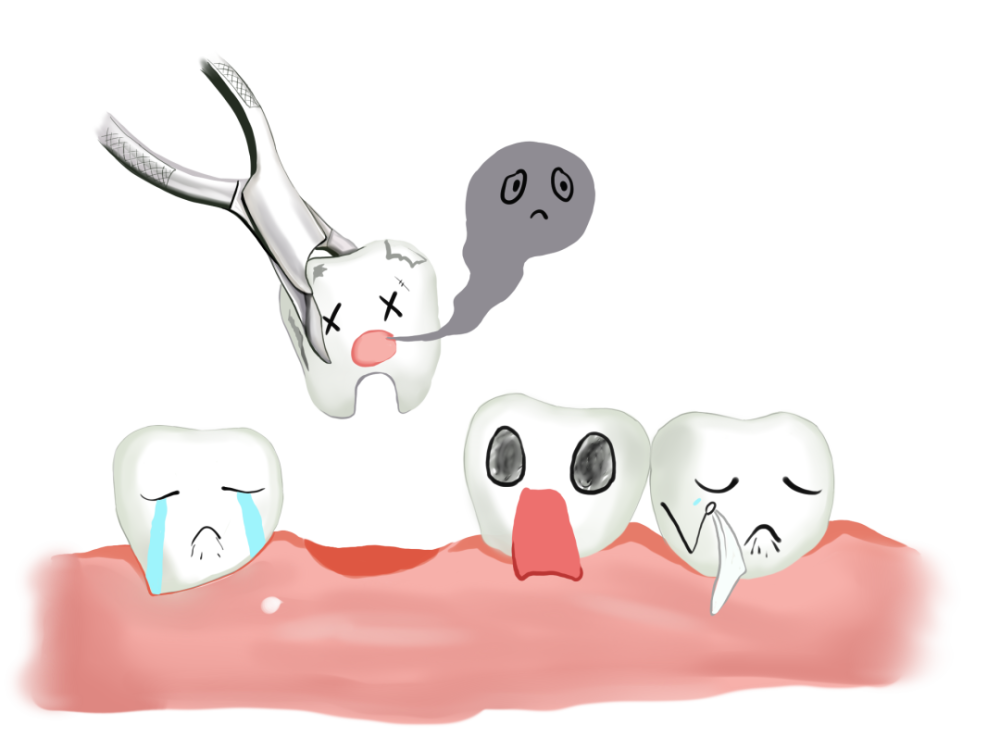 5岁女童拔牙致大出血脑死亡关于拔牙的这些事你一定要知道